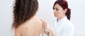 Know Your ABCDEs: How to Tell a Mole From Melanoma