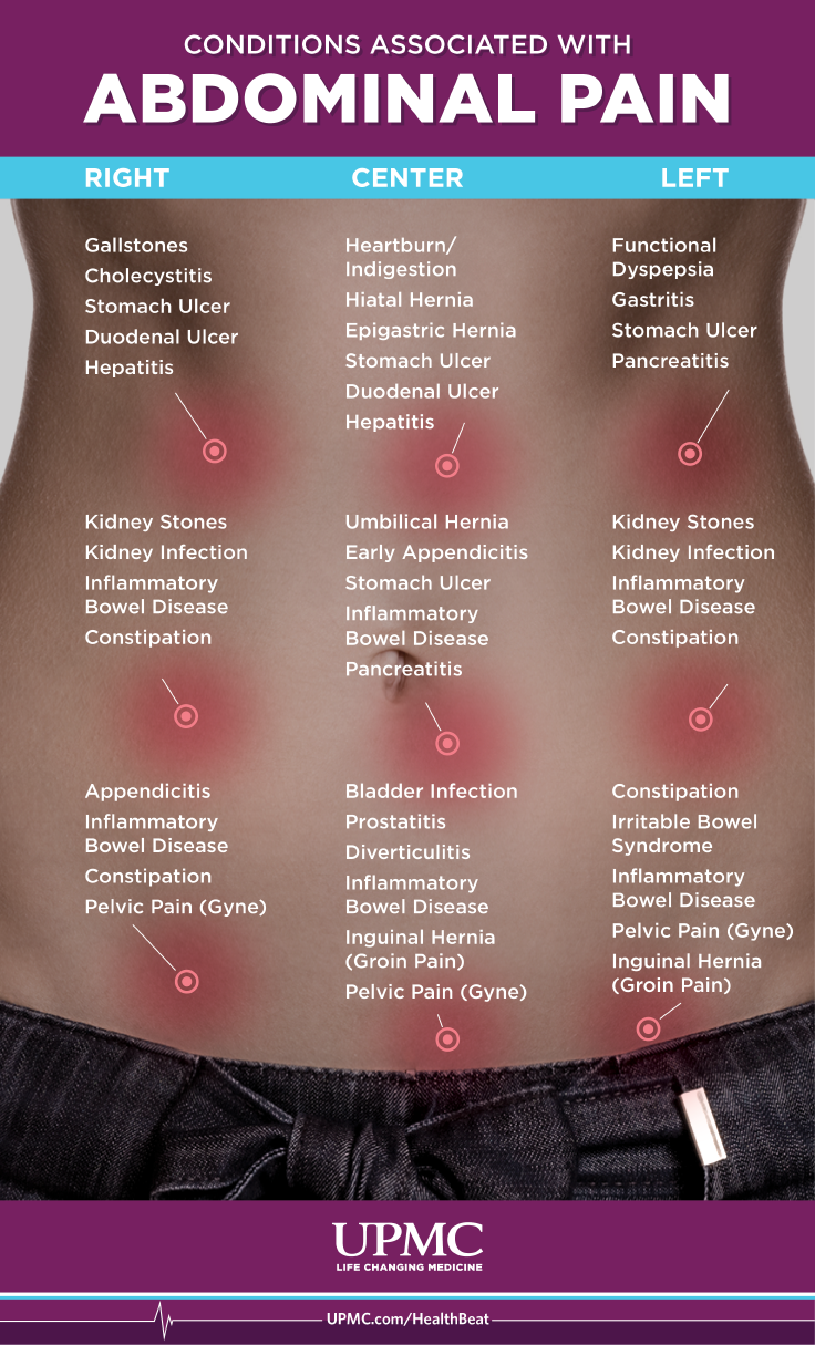 Abdominal Symptoms Chart