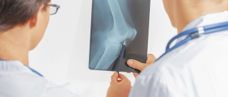 医生检查膝盖x光片，看是否有骨质疏松的迹象