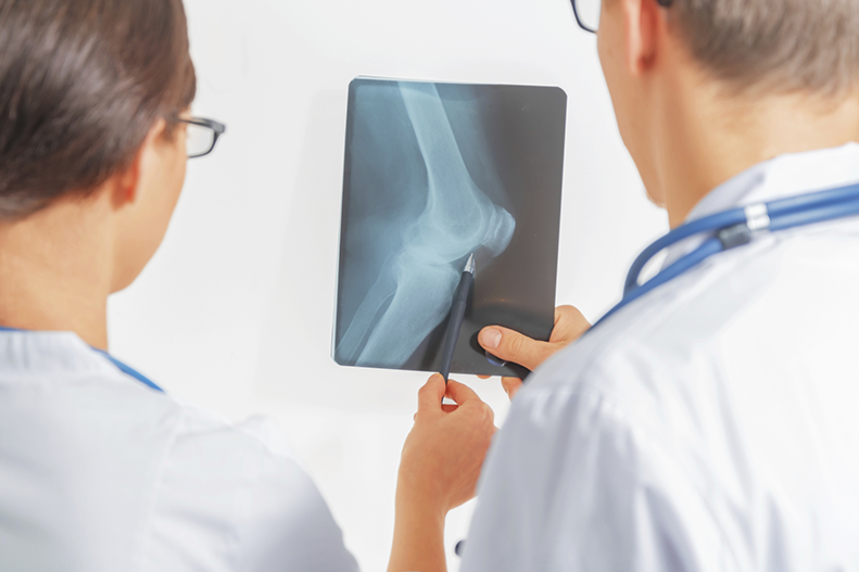 doctors examining knee x-ray for signs of osteoporosis