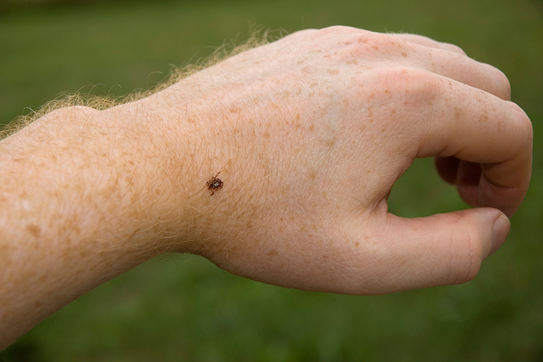 Common Insect Bites & Stings in Central Pennsylvania | UPMC HealthBeat