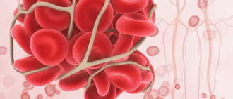 Infographic: Deep Vein Thrombosis (DVT) Facts and Stats