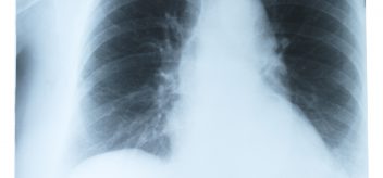 Learn about pulmonology topics
