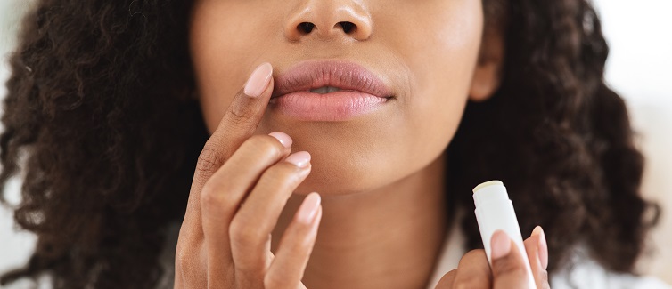 How to Chapped and Cracked Lips | UPMC HealthBeat