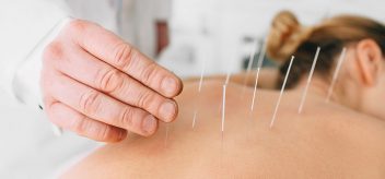 frequently asked questions about acupuncture