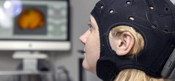 Learn about brain stimulation research for stroke patients