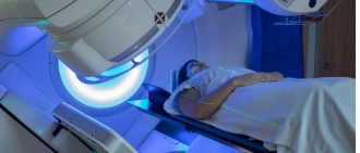 5 Things to Expect from External-Beam Radiation Therapy