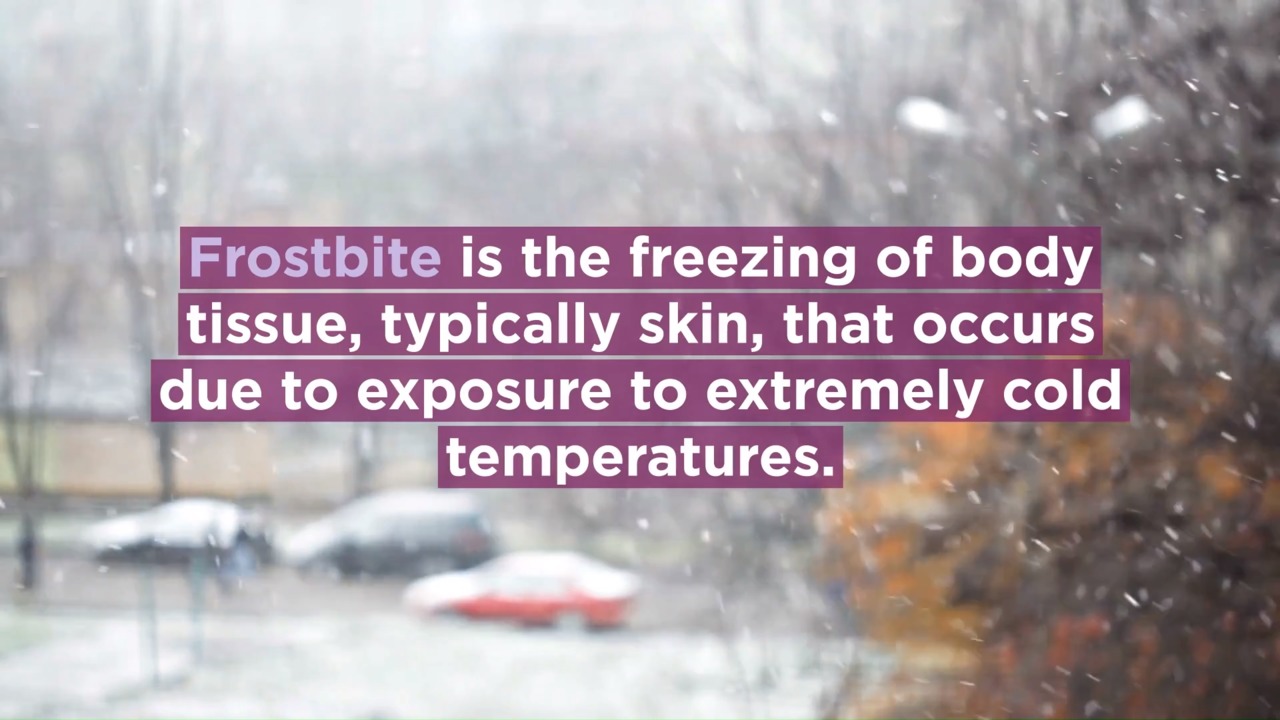 Help prevent frostbite with these tips from the experts at UPMC.