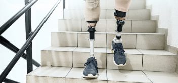 Man with prosthetic legs going down the stairs