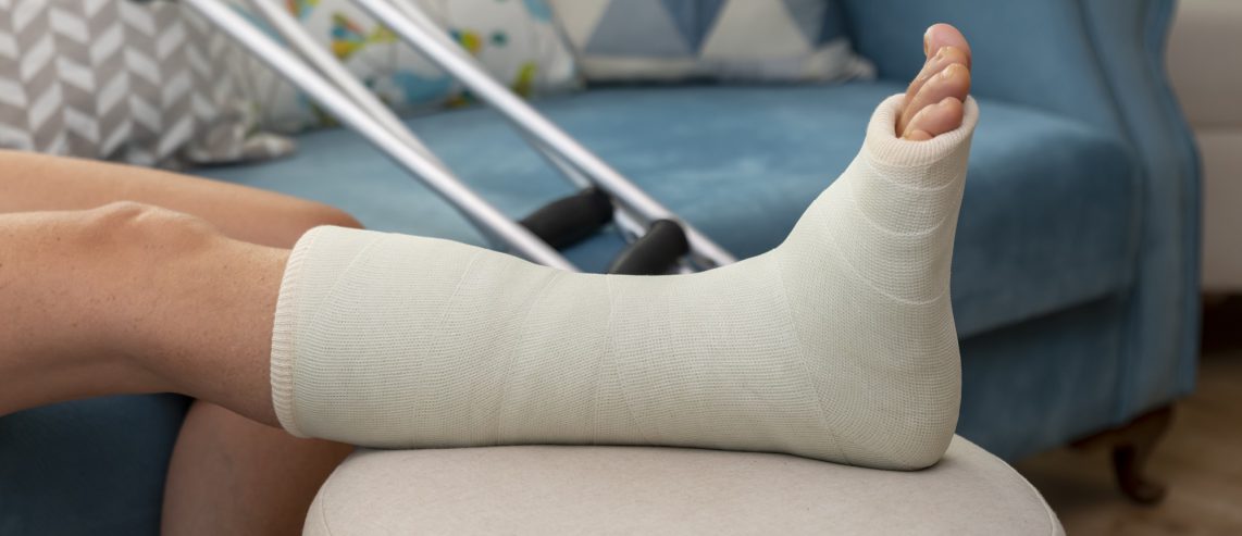 Holly’s Story: Recovering from Complex Foot and Ankle Surgery