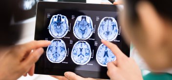 Understanding Surgery for Brain Tumors