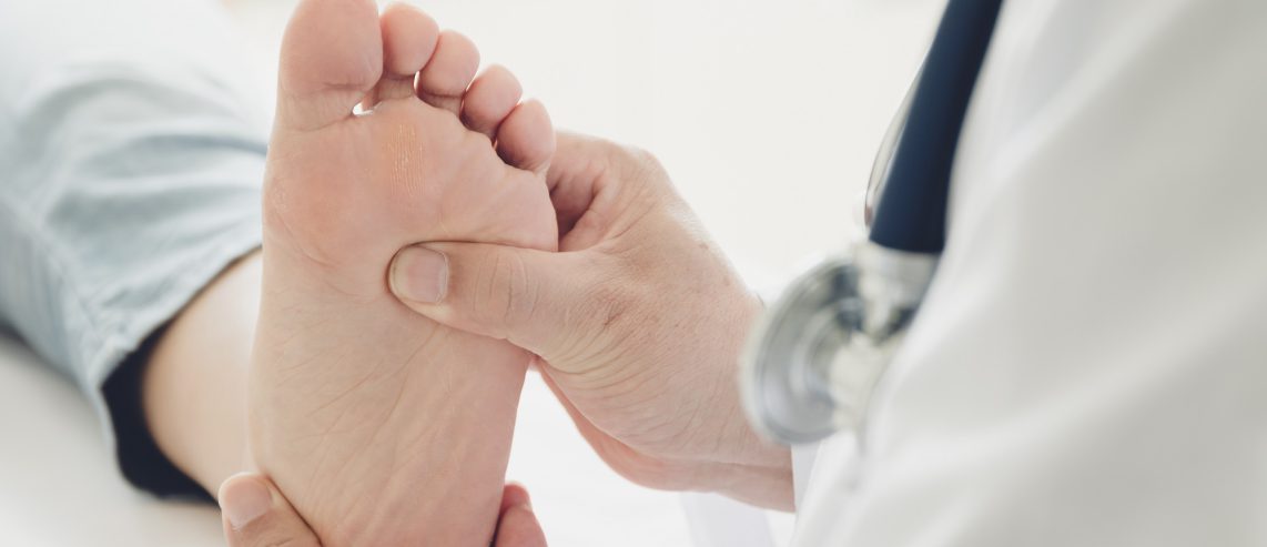 How to Know When You Need Treatment for Flat Feet